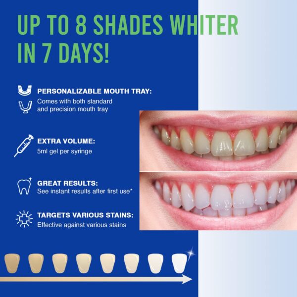 VieBeauti Teeth Whitening Kit - 5X LED Light Tooth Whitener with 35% Carbamide Peroxide, Mouth Trays, Remineralizing Gel and Tray Case - Built-in 10 Minute Timer Restores Your White Smile Mint - Image 2